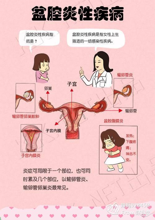 解脲支原体感染症状 解脲支原体感染的预防