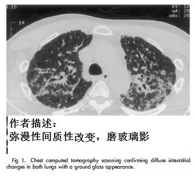 淋病 慢性淋病_男性淋病症状_淋病