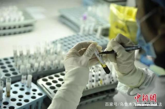 世界艾滋病日，他们需要我们的关注……