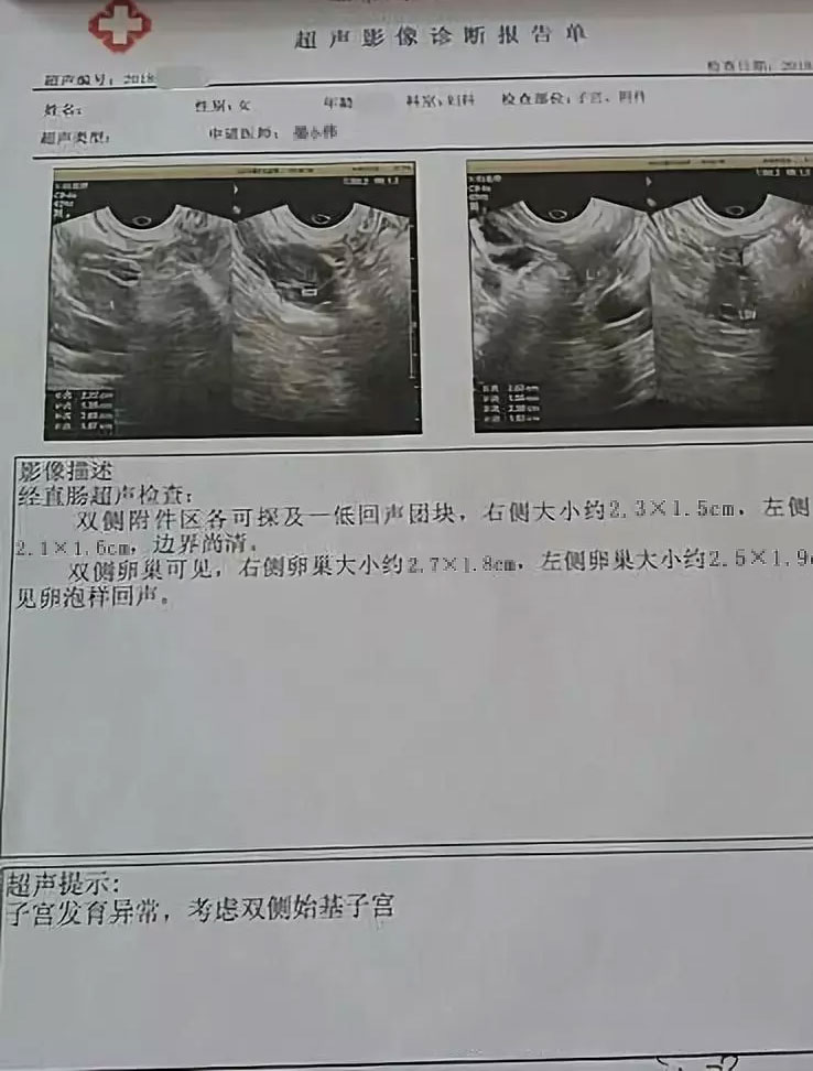 宫颈湿疣图片_宫颈尖锐湿疣_宫颈湿疣的病因