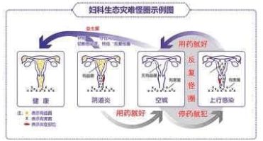 什么是性病?性病都是什么感染?与支原体有关吗?_支原体依原体的感染原因_支原体感染