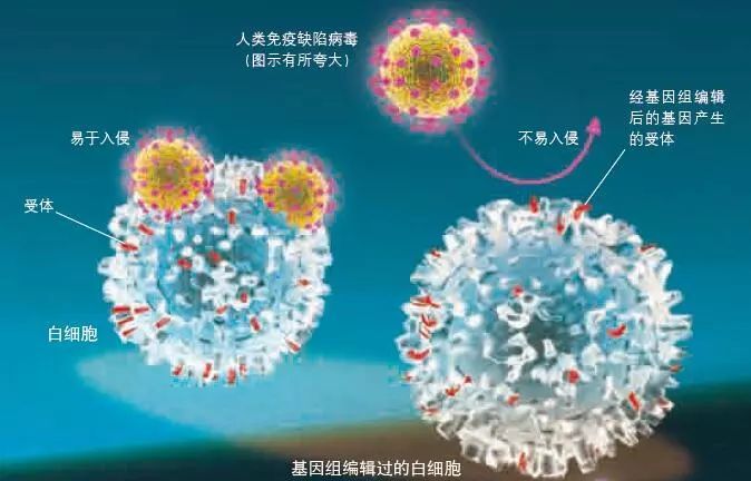 全球首例感染艾滋病痊愈女患者出现！美专家：使用了一种新疗法