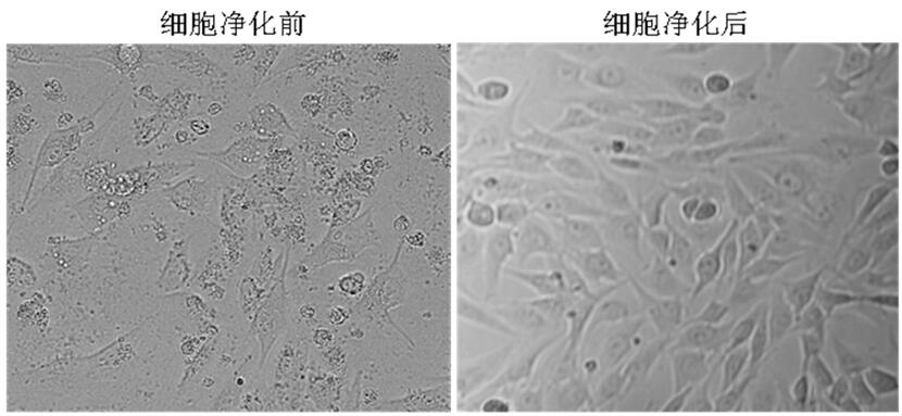 女童 感染 支原体 性病_男性感染支原体症状_支原体感染