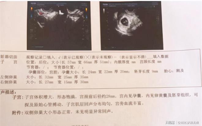 病人自诉与自述区别_艾滋病人自述_艾滋病人的自述 小姐