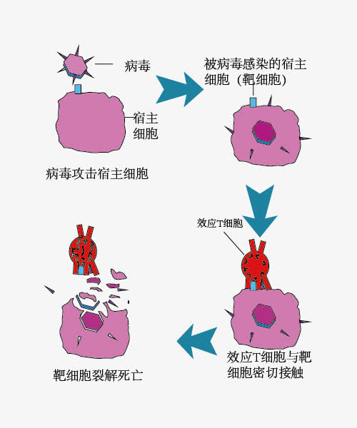 治愈艾滋病_ub421可以治愈艾滋吗_艾滋治愈十一个月一针