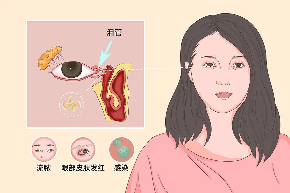 艾滋病自述_艾滋新药杀死艾滋的药_艾滋感染者自述