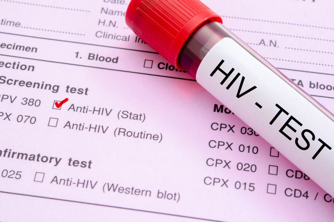 艾滋治愈研究_艾滋病治愈_ub421可以治愈艾滋吗