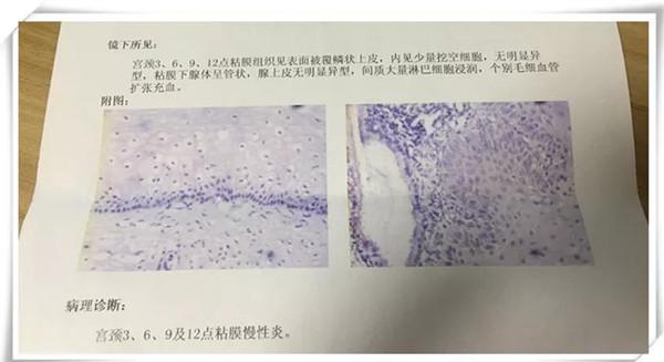 艾滋感染者自述_乙肝和艾滋那个病可怕_艾滋病自述