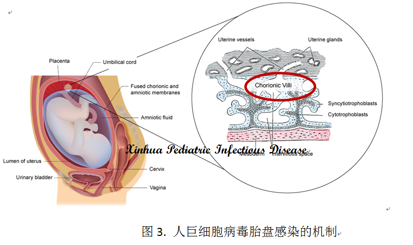 2018年艾滋功能性治愈_治愈艾滋病_2030年艾滋治愈