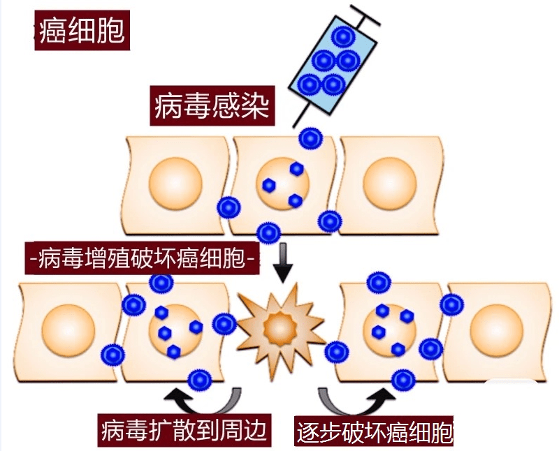 艾滋功能性治愈_治愈艾滋病_2018年艾滋功能性治愈