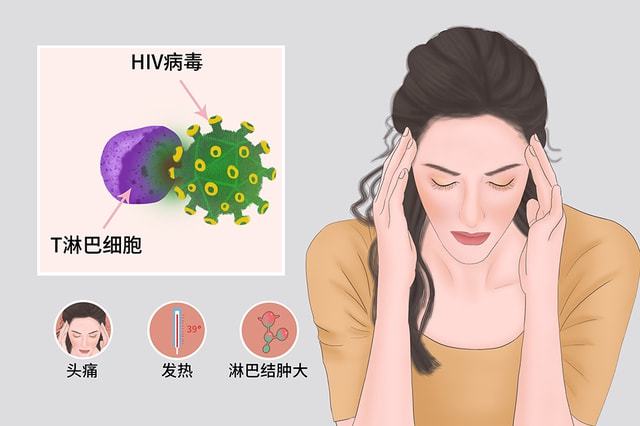 艾滋病急性期_急性艾滋病感染必有症状_艾滋急性期会全身瘙痒吗