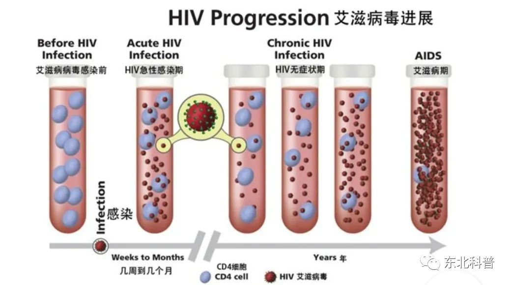 潜伏期又称什么期在艾滋病中叫什么_艾滋咽喉炎是急性还是慢性的症状_艾滋病急性期