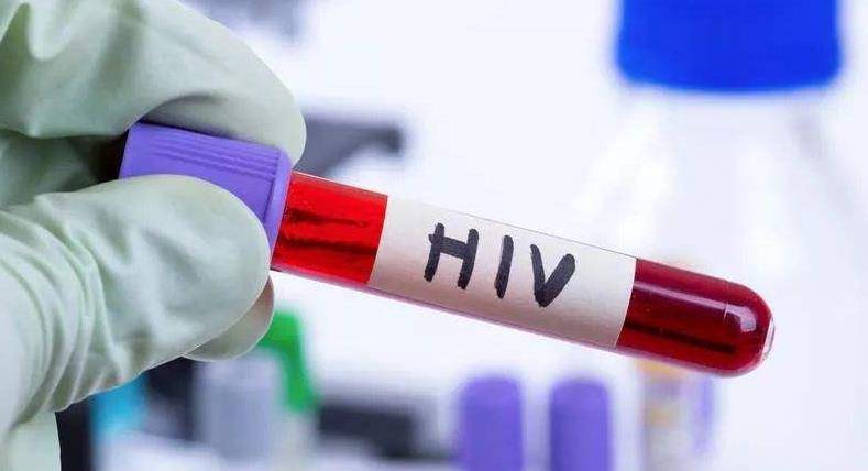 艾滋病急性期_艾滋病的哨点监测期是多久_急性化脓扁桃体 艾滋