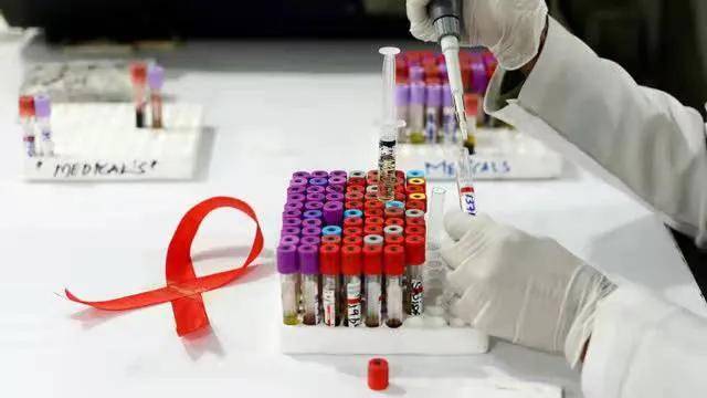 2017艾滋治愈型疫苗_艾滋治愈研究_艾滋病治愈