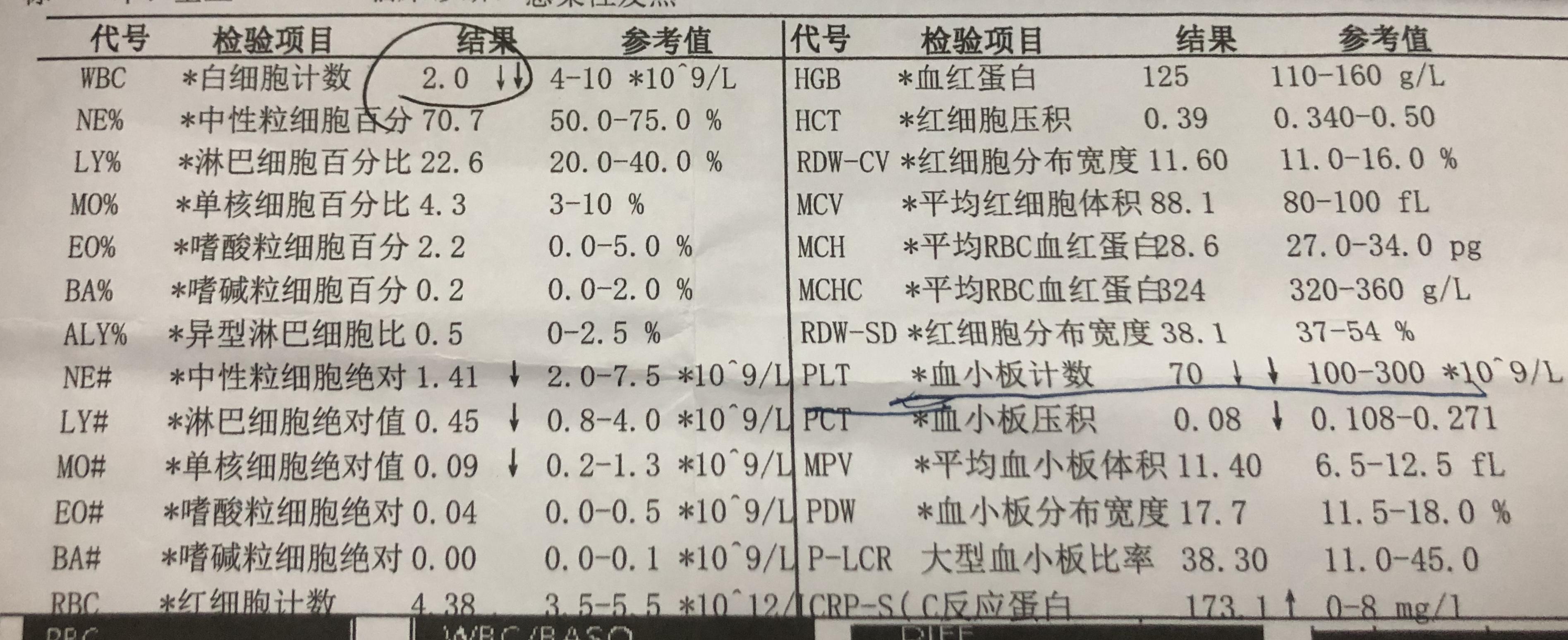 艾滋病初期_艾滋病感染初期症状_艾滋病的初期症状