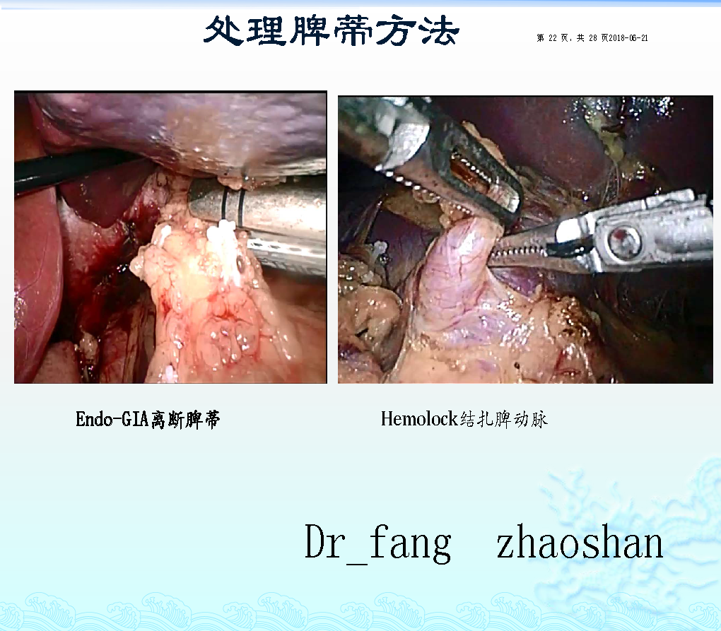 艾滋病人的自述 小姐_艾滋病人自述_丙肝病人肯定有艾滋