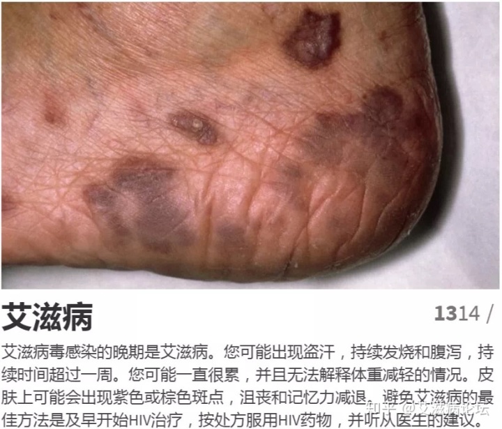 hiv边缘行为恐艾脱恐_恐艾_恐艾恐医院不敢去产检