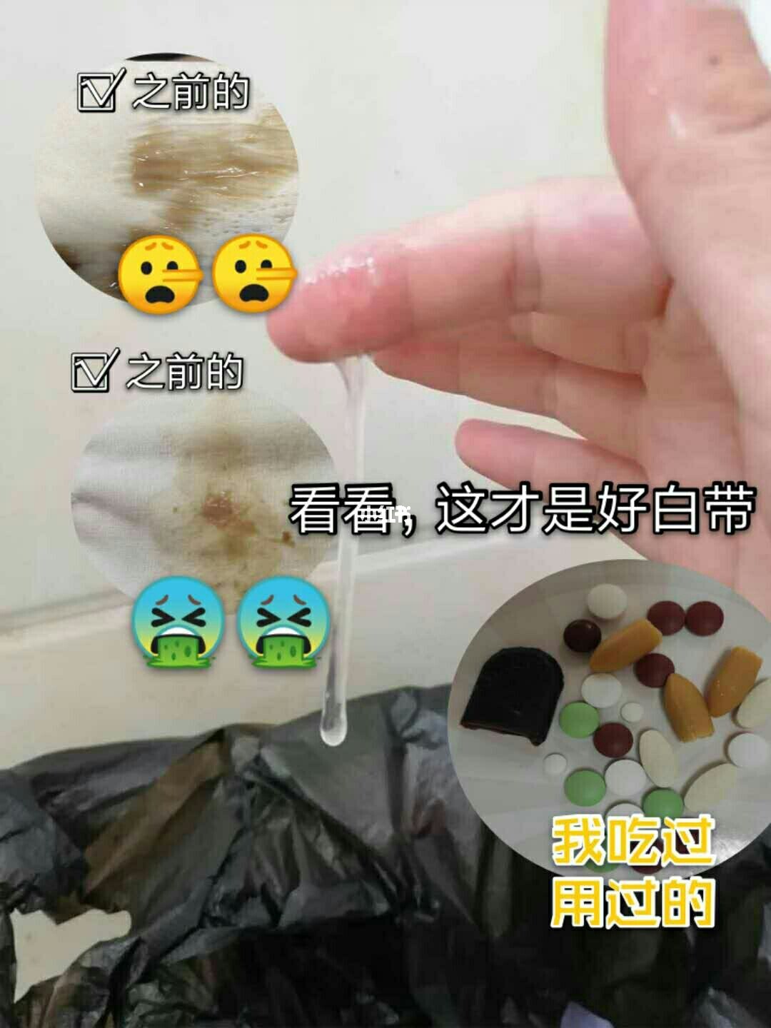 艾滋病人自述_艾滋病感染自述2017_艾滋病的感染者和病人有什么区别