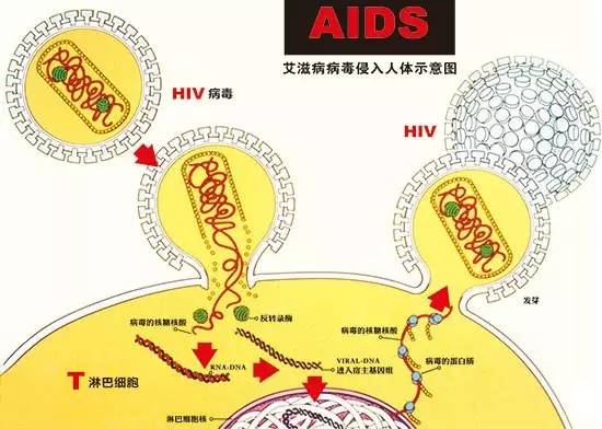 艾滋病初期_艾滋病的初期皮疹特点_艾滋病的初期症状图片