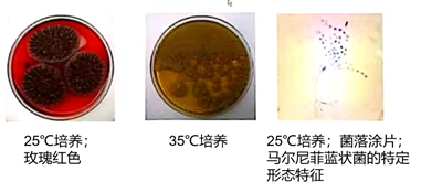 艾滋病自述_吸毒感染艾滋病的自述_艾滋病感染自述2017