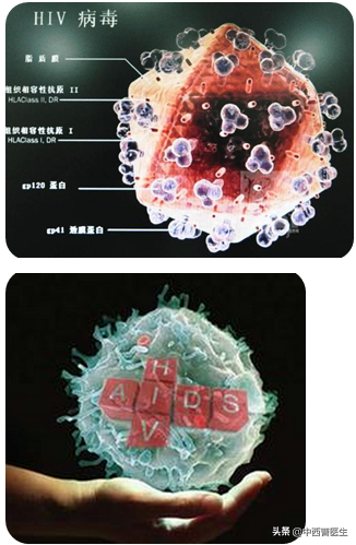 急性化脓扁桃体 艾滋_艾滋病急性期_口腔粘膜病破损艾滋