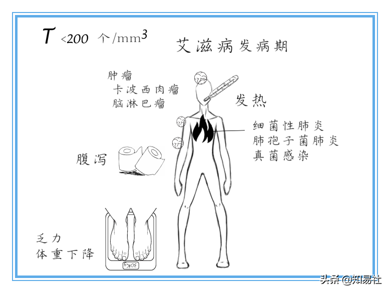 2030年艾滋治愈_艾滋能不能治愈_治愈艾滋病