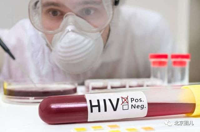 艾滋病初期_艾滋病的初期症状图_感染艾滋病的初期症状