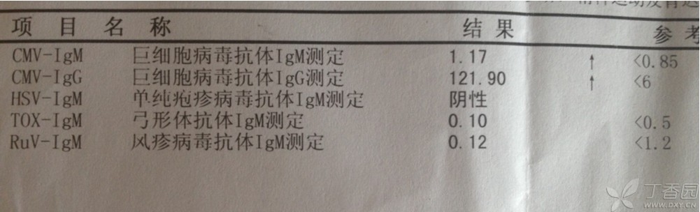 艾滋病急性期_急性艾滋病感染必有症状_艾滋病的哨点监测期是多久