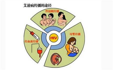 艾滋有急性咽喉炎症状吗_急性艾滋病感染必有症状_艾滋病急性期