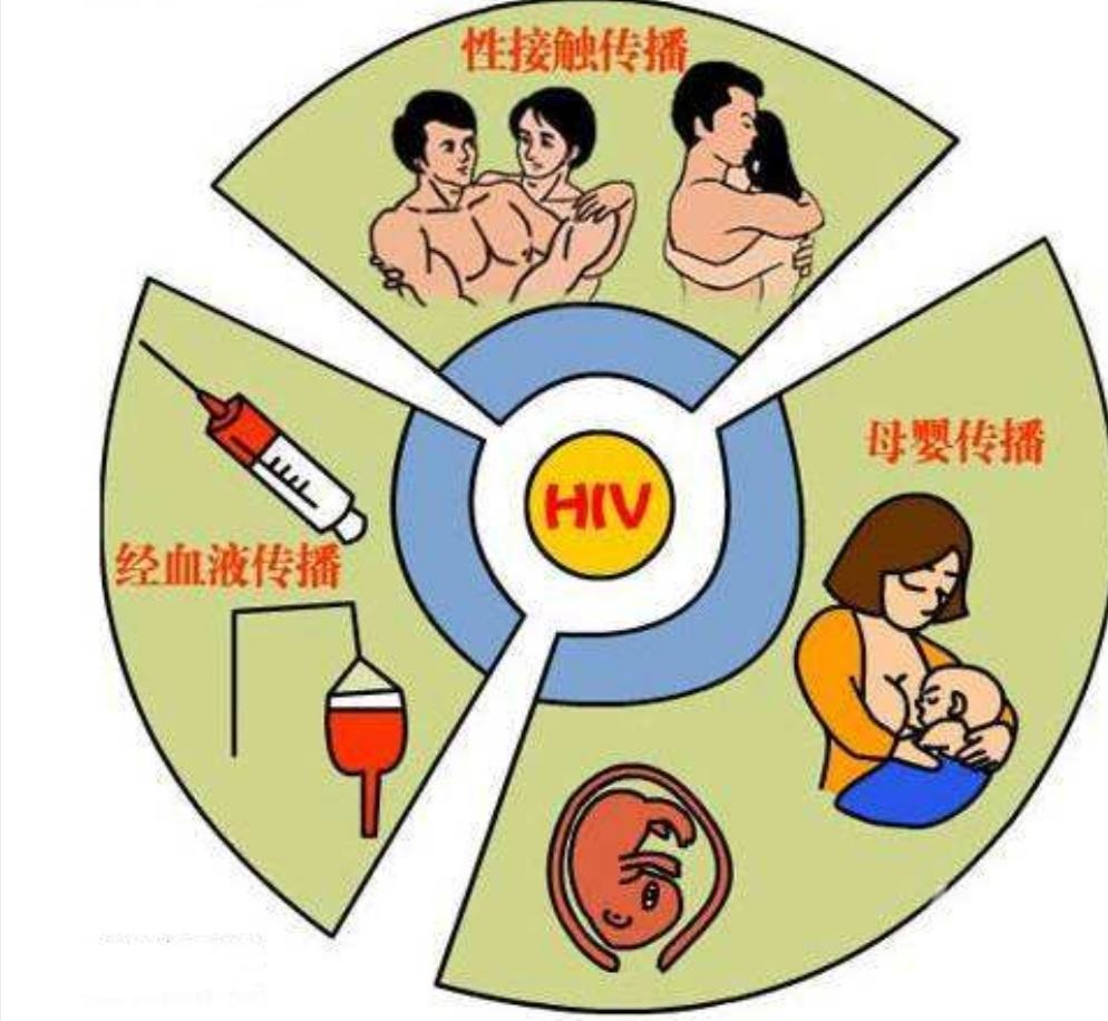 艾滋初期皮肤症状图片_艾滋病的初期皮疹特点_艾滋病初期