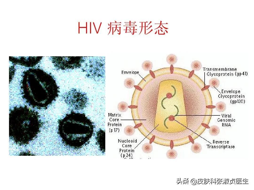 艾滋病初期_女性得艾滋病的初期症状图片_艾滋病的初期症状图片女