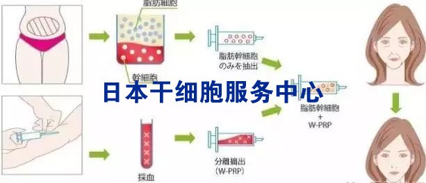 艾滋病治愈_好久才出治愈艾滋病药_2018艾滋最新治愈信息