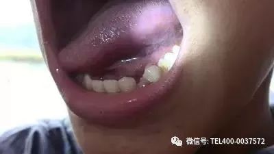 乙肝和艾滋那个病可怕_艾滋病急性期_下列哪项是艾滋病的哨点监测期