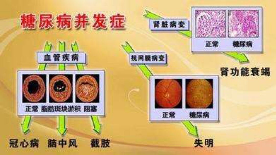 恐艾_恐采血针恐艾吧_大爱脱恐吧 大爱恐艾吧