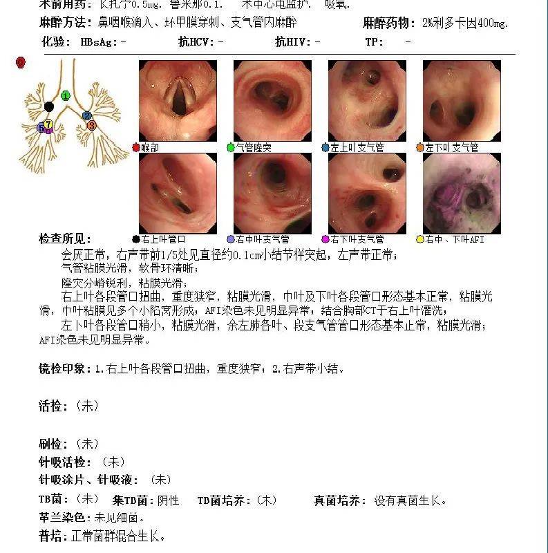 艾滋病自述_艾滋病感染自述2017_一个艾滋病人的自述