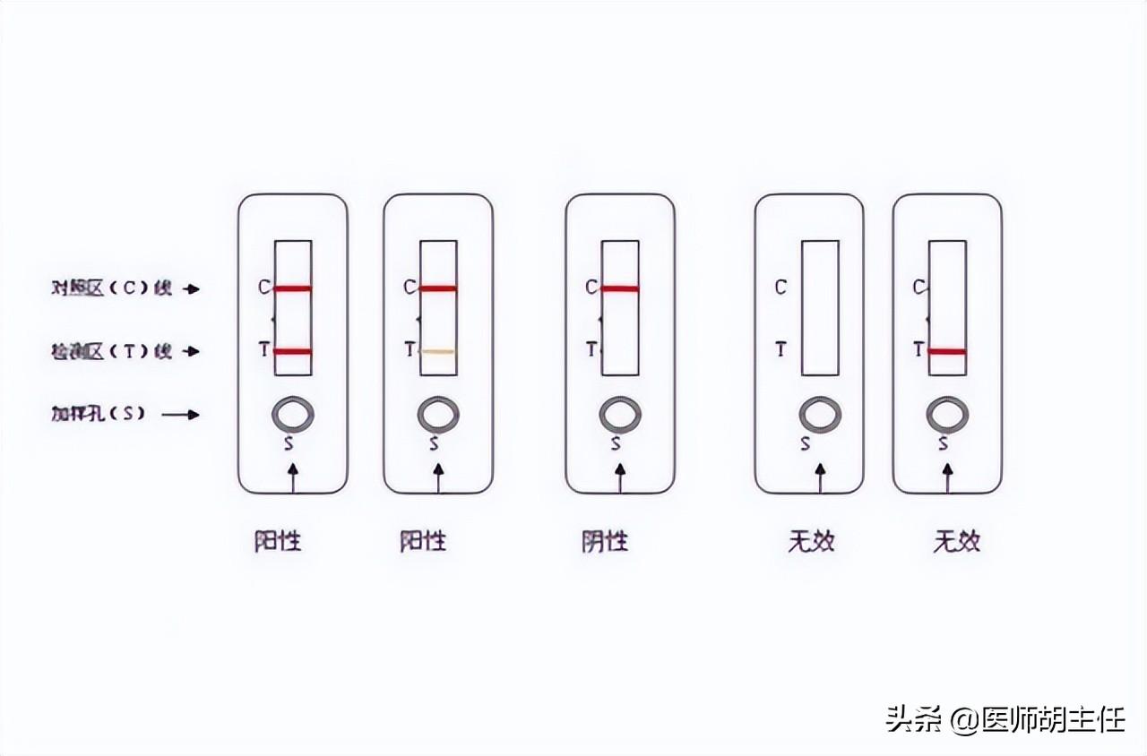 艾滋病的初期皮疹特点_艾滋病初期_艾滋初期盗汗是长期吗