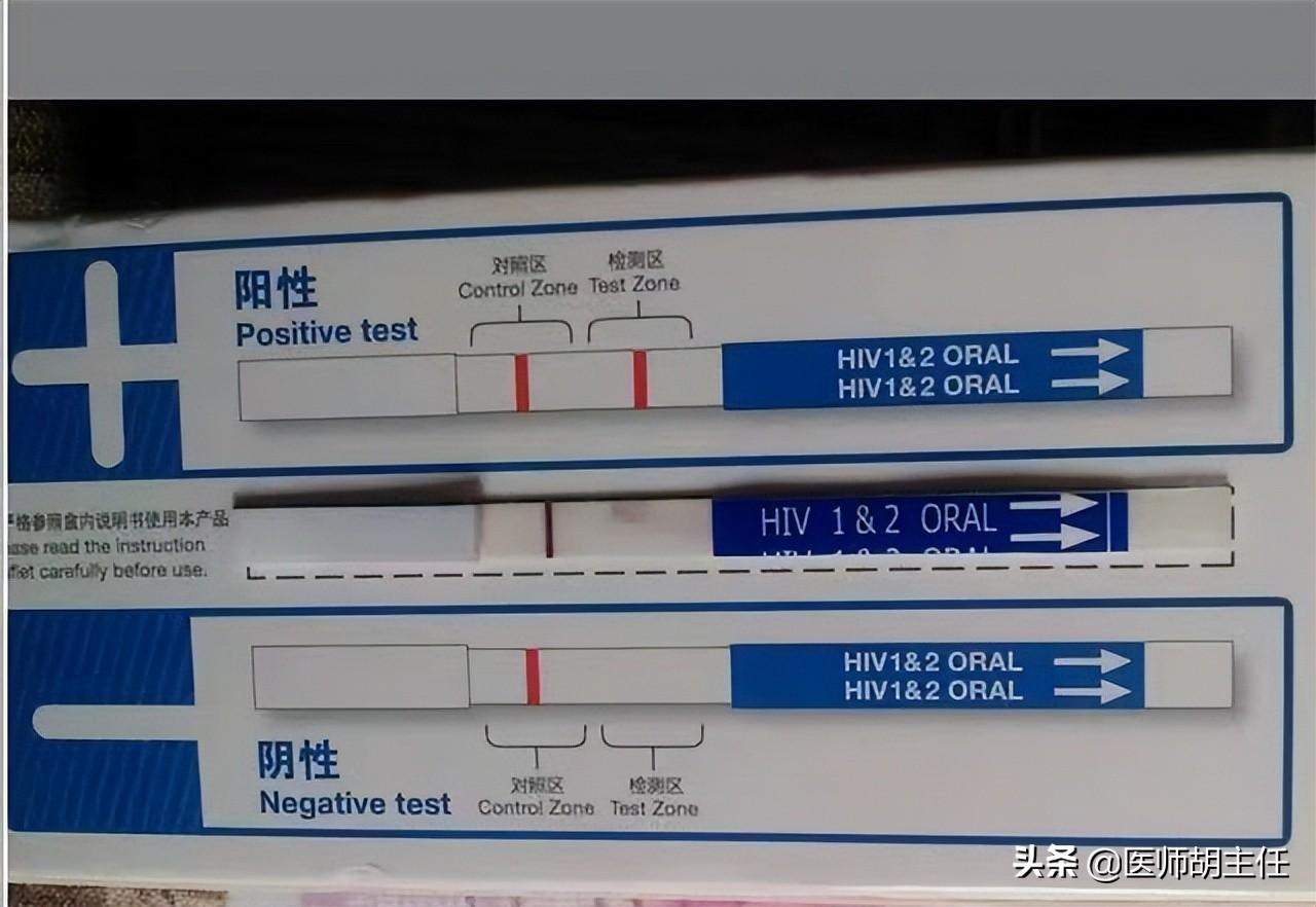 艾滋病的初期皮疹特点_艾滋病初期_艾滋初期盗汗是长期吗