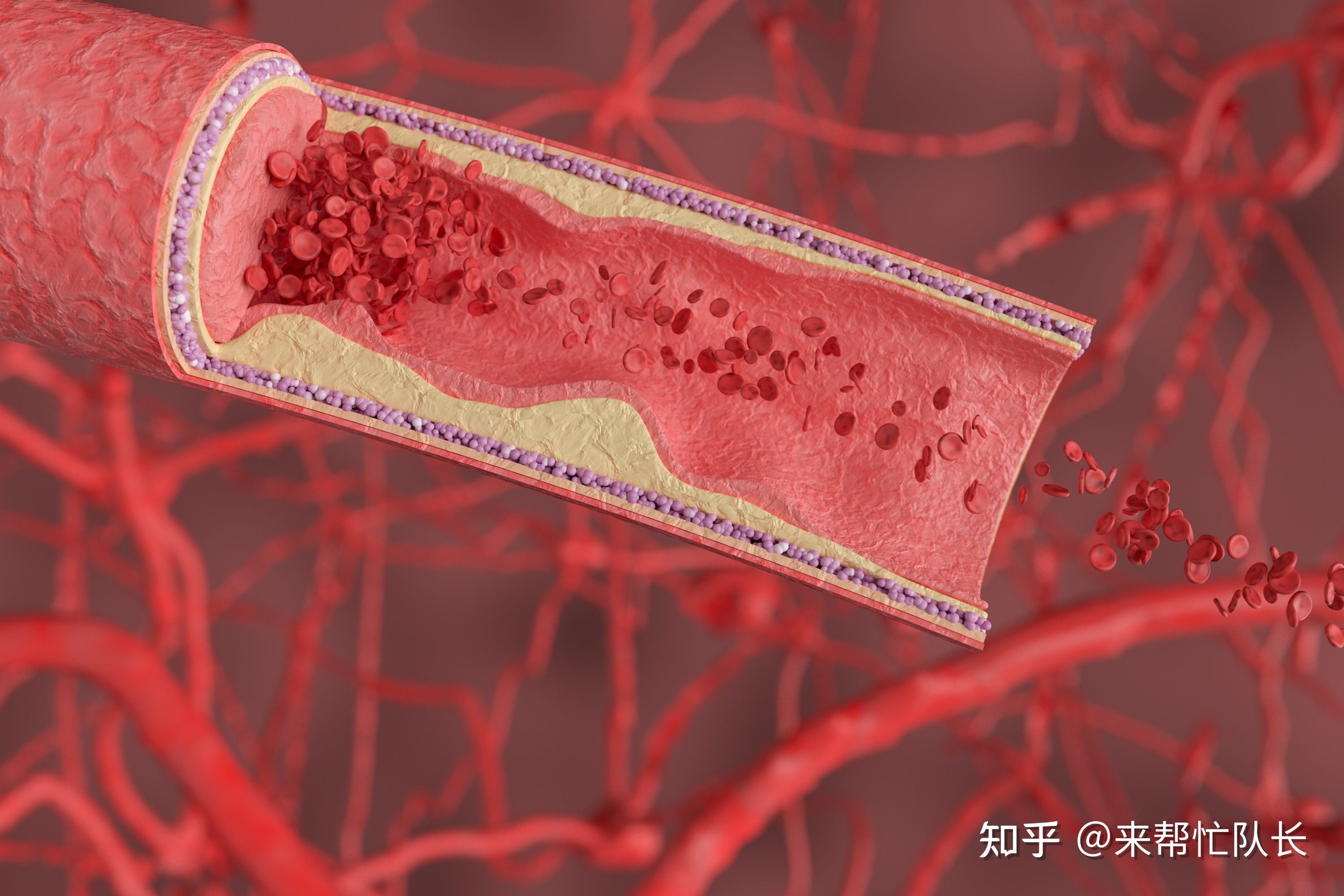 艾滋病治愈_西班牙功能性治愈艾滋_有治愈艾滋病的中药吗