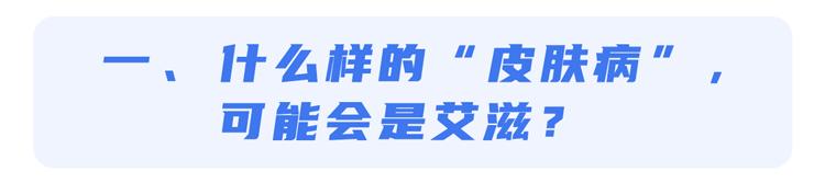 艾滋病感染一般初期会有什么症状_艾滋病初期_艾滋病的初期症状及传播途径