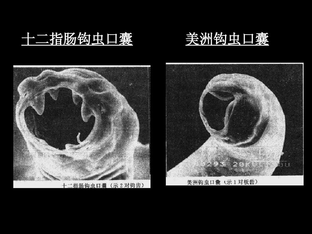 下列哪项是艾滋病的哨点监测期_艾滋病急性期_艾滋病的哨点监测期是多久