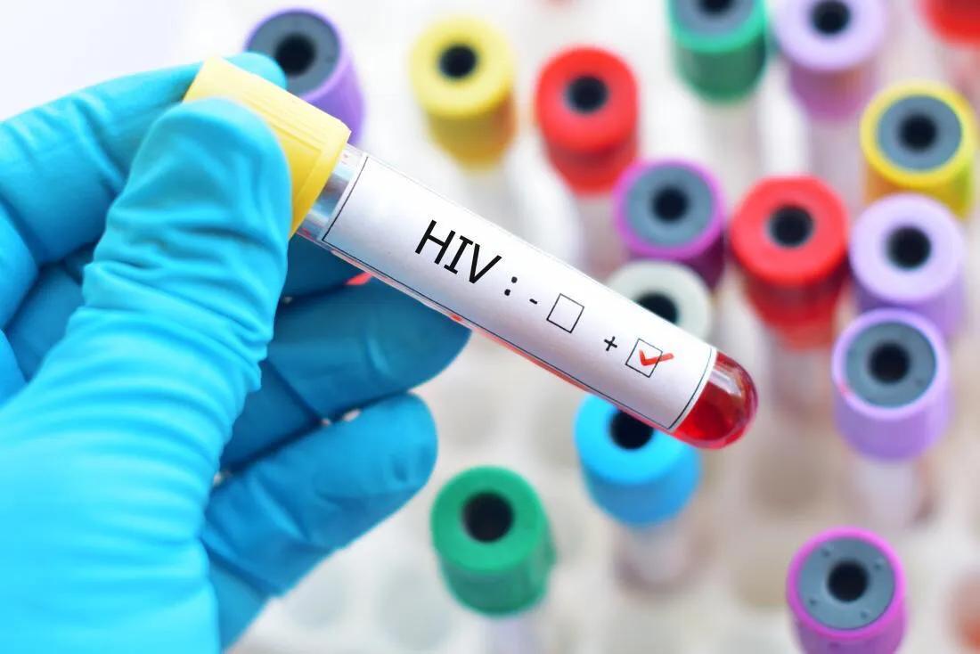 艾滋病的哨点监测期是几个月_乙肝和艾滋那个病可怕_艾滋病急性期