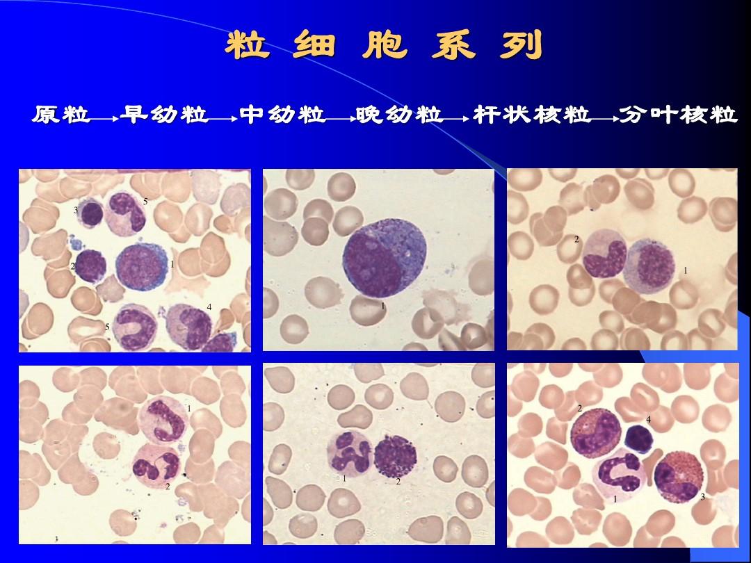 潜伏期又称什么期在艾滋病中叫什么_艾滋病急性期_艾滋咽喉炎是急性还是慢性的症状