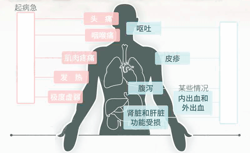 急性艾滋病的初期症状_艾滋病的哨点监测期是几个月_艾滋病急性期