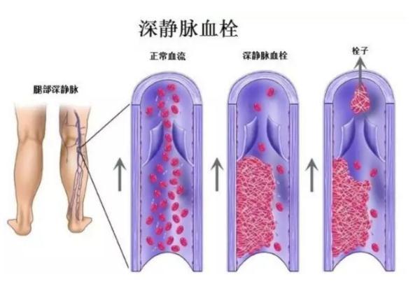 修脚出血了,会感染艾滋和其她病吗_艾滋病急性期_乙肝和艾滋那个病可怕