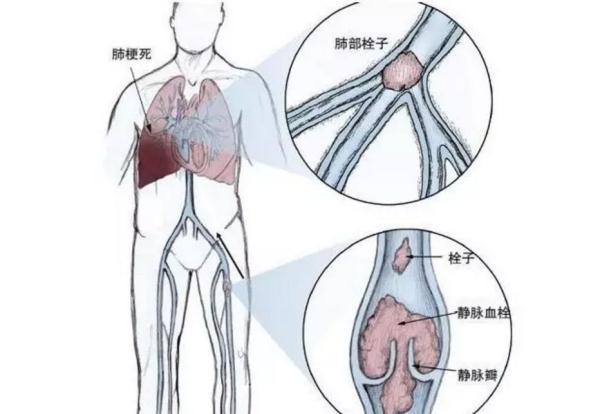 修脚出血了,会感染艾滋和其她病吗_乙肝和艾滋那个病可怕_艾滋病急性期