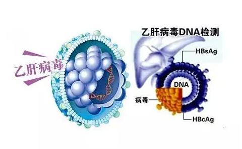 急性化脓扁桃体 艾滋_艾滋病急性期_艾滋急性