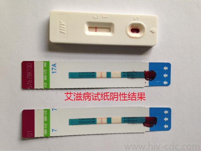 患艾滋病者潜伏期症状自述_艾滋病自述_乙肝和艾滋那个病可怕