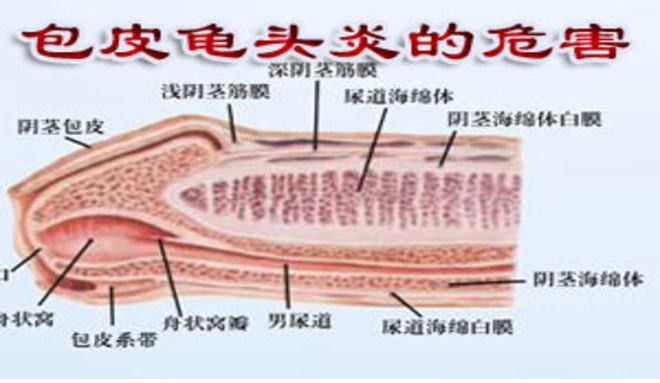 艾滋病感染一般初期会有什么症状_艾滋病的初期症状及传播途径_艾滋病初期