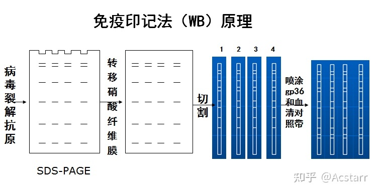 艾滋急性_艾滋病急性期_急性胃扩张病人可发生