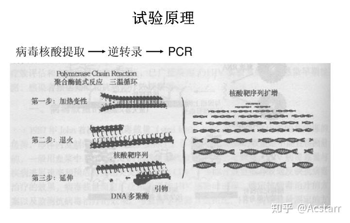 艾滋急性_急性胃扩张病人可发生_艾滋病急性期